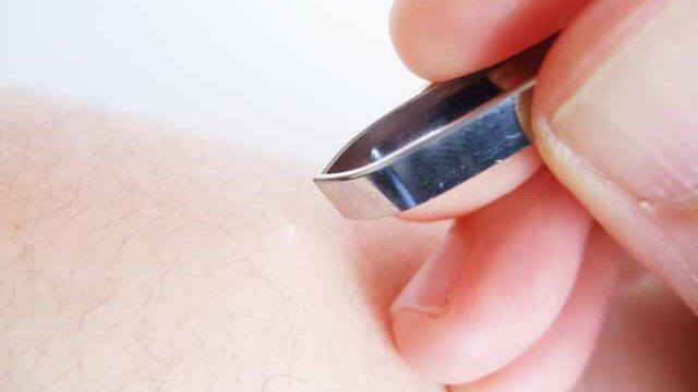 毛抜きを使って毛を抜くシーン　アップ
